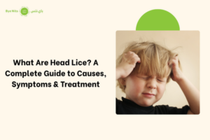 What Are Head Lice A Complete Guide to Causes, Symptoms & Treatment