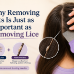 Why Removing Nits Is Just as Important as Removing Lice
