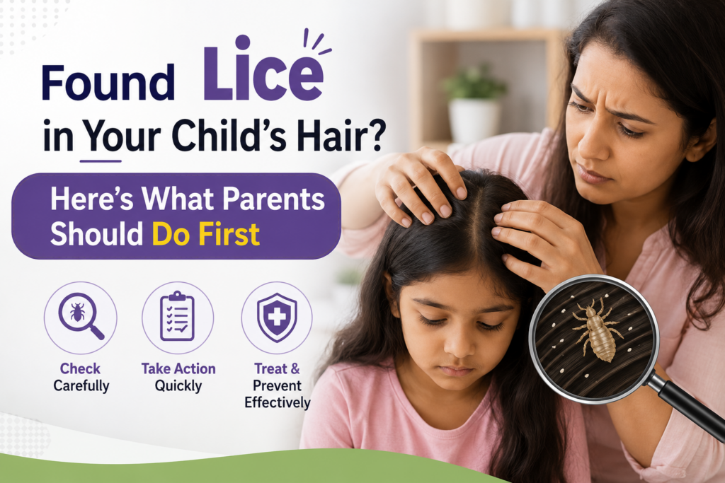Found Lice in Your Child's Hair? Here's What Parents Should Do First